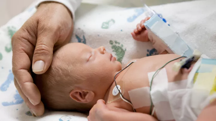 An adult hand rests gently on the head of a sleeping baby in the hospital. Monitoring wires are attached to the baby’s chest.