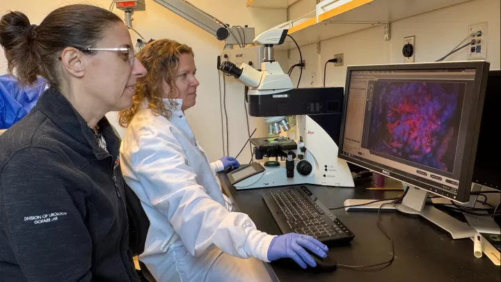 Two female researchers examine a slide of brightly colored liver cells on a computer monitor connected to a microscrope