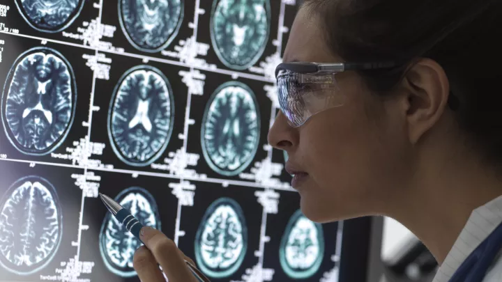 A doctor uses a pen to point to a series of brain MRIs on a computer screen. Her dark hair is pulled back and she wears glasses.