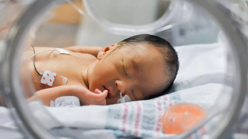 A newborn baby lays sleeping in an incubator. A tube is placed in their nose and wires are attached to their chest.