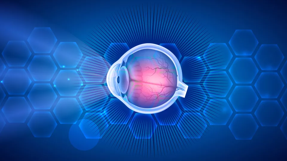 Retinoblastoma Treatment - NCI