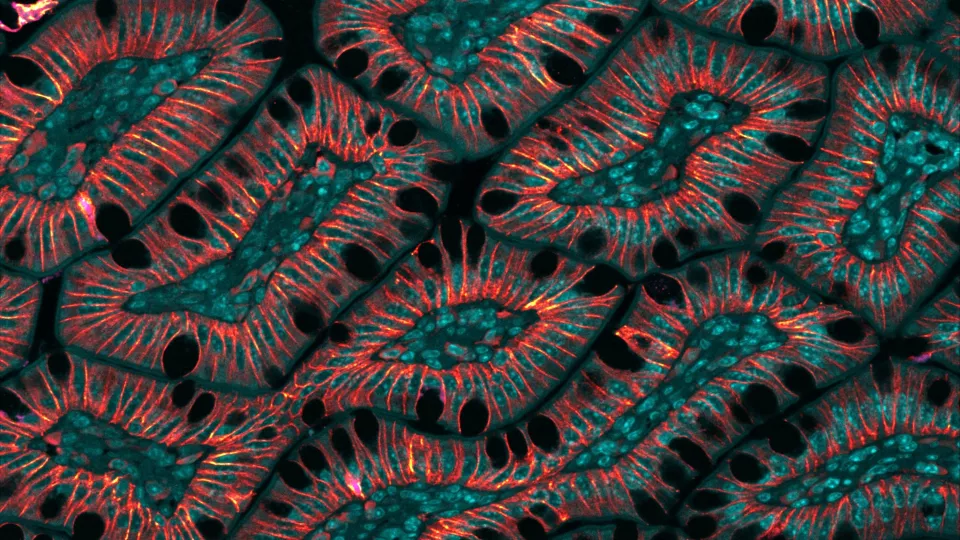 Brightly colored scanned image of human cells