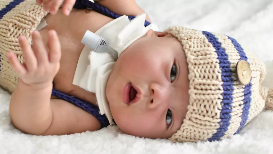 Baby with light skin wearing knit cap lying on side with tube in neck