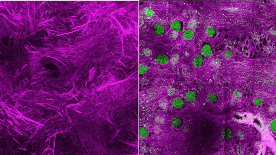 Left image shows a magenta swirl of fibrous strands. Right image shows a smoother magenta surface with several small green circles.