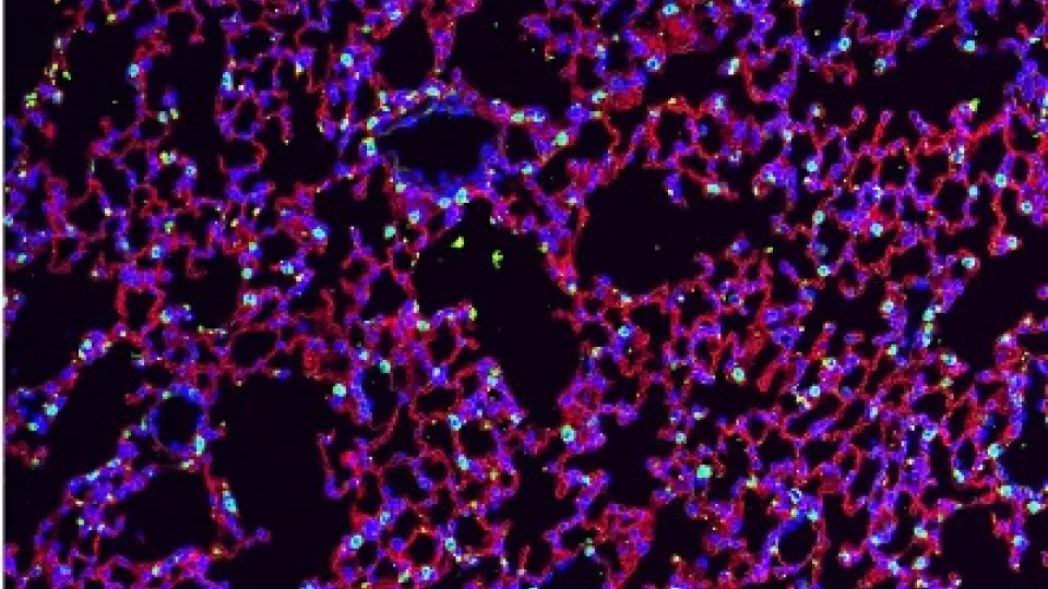 Scanned image of brightly colored lung cells