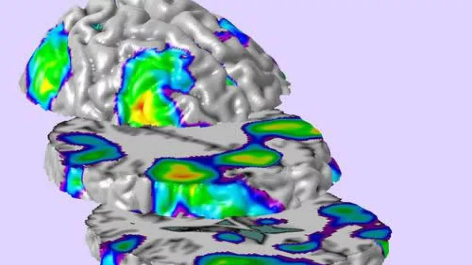 Brightly colored image of brain scan in sections