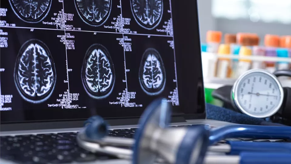 A computer screen shows several images of a brain MRI. A stethoscope and blood pressure cuff are lying next to it.