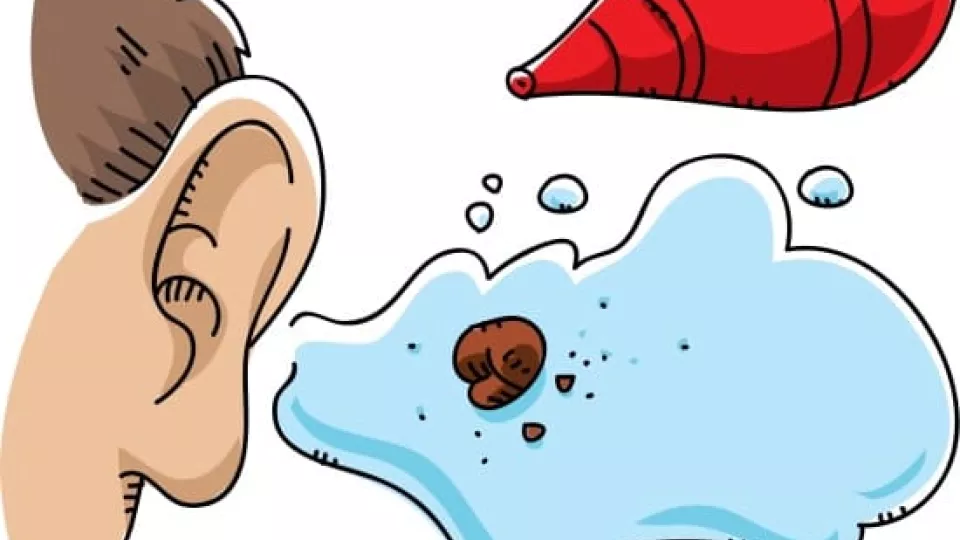 The best way to clean a child's earwax - CHOC - Children's health hub