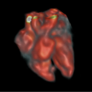 Fetal cardiac 3D MRI at low field