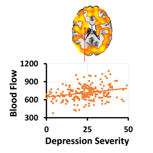 Chart mapping cerebral blood flow and depression severity