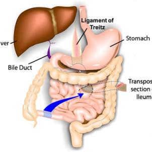 CHLA-Kohli- Figure 1.jpg