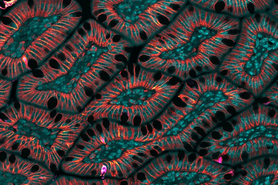 Brightly colored scanned image of human cells