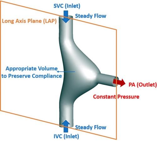 A diagram of how an artificial right atrium would connect to the heart