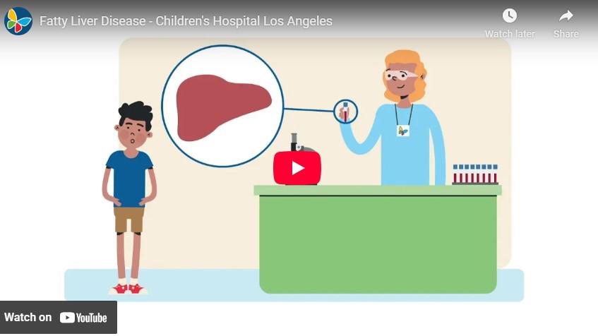 Screengrab of YouTube video player displaying an animated healthcare provider examining a liver sample with a young patient